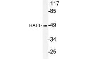 Western blot analysis of HAT1 antibody in extracts from LOVO cells. (HAT1 antibody)