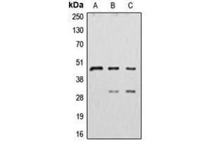 Western blot analysis of Cathepsin D expression in HepG2 (A), MDAMB231 (B), MCF7 (C) whole cell lysates.
