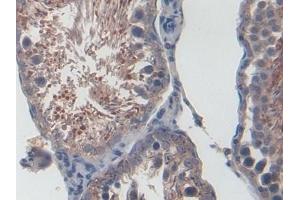 Immunohistochemistry (IHC) image for anti-Chemokine (C-X-C Motif) Ligand 1 (Melanoma Growth Stimulating Activity, Alpha) (CXCL1) (AA 25-96) antibody (ABIN7430528)