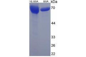 Image no. 2 for Vitamin E peptide (BSA) (ABIN5666017) (Vitamin E peptide (BSA))