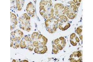 Immunohistochemistry of paraffin-embedded Human stomach using HDAC6 Polyclonal Antibody at dilution of 1:100 (40x lens). (HDAC6 antibody)