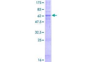 CCR5 Protein (AA 1-352) (GST tag)