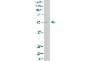 MEF2D MaxPab rabbit polyclonal antibody. (MEF2D antibody  (AA 1-521))