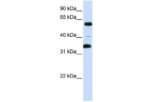 Western Blot showing ZKSCAN1 antibody used at a concentration of 1-2 ug/ml to detect its target protein.