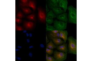 ABIN6256960 and ABIN6274918 staining  cells by IF/ICC. (BMP10 antibody  (Internal Region))
