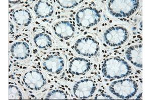 Image no. 2 for anti-TYRO3 Protein Tyrosine Kinase (TYRO3) antibody (ABIN1501608) (TYRO3 antibody)