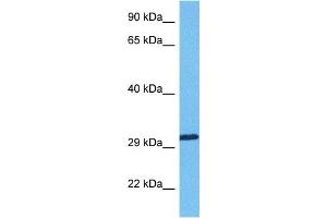 Host:  Rabbit  Target Name:  RBM7  Sample Tissue:  Human Lung Tumor  Antibody Dilution:  1ug/ml (RBM7 antibody  (Middle Region))