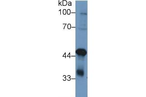 Detection of TDP43 in Human K562 cell lysate using Polyclonal Antibody to Tar DNA Binding Protein 43 kDa (TDP43) (TARDBP antibody  (AA 104-262))