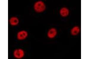 ABIN6277188 staining Hela by IF/ICC. (UHRF1 antibody  (N-Term))