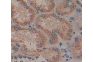 Figure. (HGD antibody  (AA 8-205))