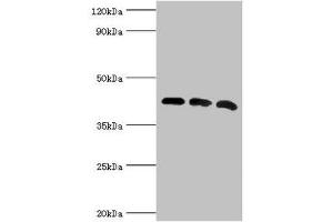 Western blot All lanes: Alpha-centractin antibody at 8 μg/mL Lane 1: Mouse brain tissue Lane 2: MCF-7 whole cell lysate Lane 3: Mouse liver tissue Secondary Goat polyclonal to rabbit IgG at 1/10000 dilution Predicted band size: 43 kDa Observed band size: 43 kDa