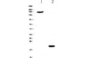 Western blot analysis of COL18A1 using anti-COL18A1 antibody .