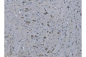 IHC analysis of TMPRSS3 using anti-TMPRSS3 antibody (ABIN7601198).