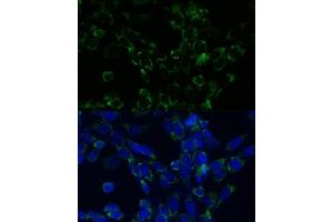 Immunofluorescence analysis of NIH-3T3 cells using GLUD1 antibody (ABIN6127975, ABIN6141157, ABIN6141158 and ABIN6223546) at dilution of 1:100. (GLUD1 antibody  (AA 54-240))