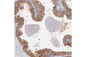 Immunohistochemical staining (Formalin-fixed paraffin-embedded sections) of human prostate with NFKBIE polyclonal antibody  shows cytoplasmic positivity in glandular cells at 1:50-1:200 dilution. (NFKBIE antibody)