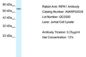 WB Suggested Anti-RIPK1  Antibody Titration: 0. (RIPK1 antibody  (Middle Region))