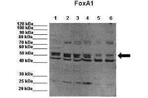 Western Blotting (WB) image for anti-Forkhead Box A1 (FOXA1) (C-Term) antibody (ABIN2779762)