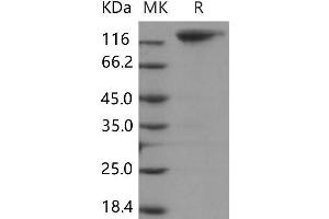 Western Blotting (WB) image for C-Mer Proto-Oncogene Tyrosine Kinase (MERTK) protein (Fc Tag) (ABIN7194456) (MERTK Protein (Fc Tag))