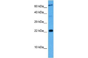 Host:  Mouse  Target Name:  MAFK  Sample Tissue:  Mouse Liver  Antibody Dilution:  1ug/ml (Mafg antibody  (Middle Region))