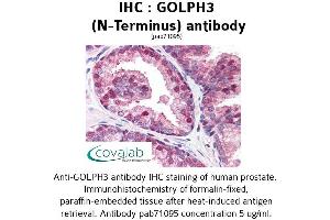 Image no. 1 for anti-Golgi phosphoprotein 3 (Coat-Protein) (GOLPH3) (N-Term) antibody (ABIN1734859) (GOLPH3 antibody  (N-Term))