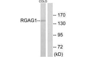 Western blot analysis of extracts from COLO cells, using RGAG1 antibody. (Retrotransposon Gag-Like Protein 9 (RTL9) (C-Term) antibody)