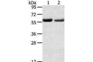 Western Blot analysis of Human normal stomach and stomach cancer tissue using SLC16A9 Polyclonal Antibody at dilution of 1:200