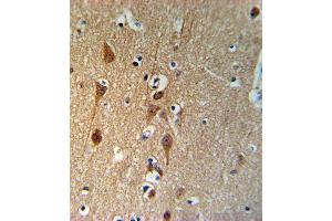 Immunohistochemistry (Paraffin-embedded Sections) (IHC (p)) image for anti-SMAD, Mothers Against DPP Homolog 3 (SMAD3) (AA 186-215) antibody (ABIN653953)