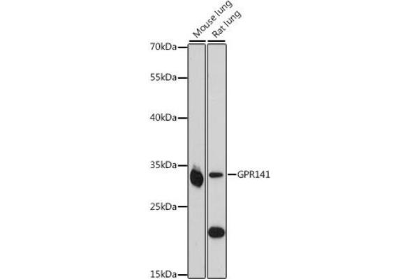 GPR141 Antikörper  (AA 50-150)