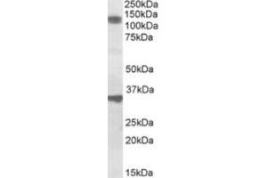 Western Blotting (WB) image for anti-Cell Division Cycle and Apoptosis Regulator 1 (CCAR1) (Internal Region) antibody (ABIN2464383) (CCAR1 antibody  (Internal Region))
