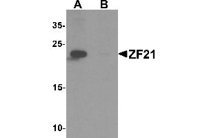 Western blot analysis of ZF21 in 3T3 cell tissue lysate with ZF21 antibody at 1 µg/mL in (A) the absence and (B) the presence of blocking peptide. (ZFYVE21 antibody  (N-Term))