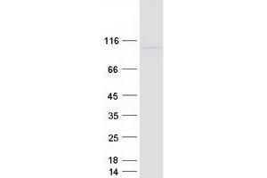 Validation with Western Blot