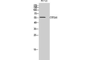 Western Blot analysis of PC-12 cells using CYP2A6 Polyclonal Antibody diluted at 1:1000.