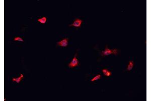 Immunofluorescence (fixed cells) (IF/ICC) image for anti-CD151 (CD151) (N-Term) antibody (ABIN6260576)