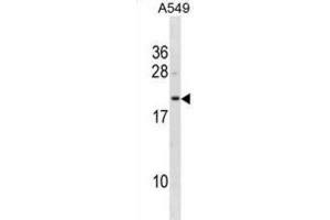 Western Blotting (WB) image for anti-Flavin Reductase (BLVRB) antibody (ABIN3001274) (BLVRB antibody)