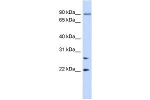WB Suggested Anti-JOSD2 Antibody Titration: 0. (JOSD2 antibody  (N-Term))