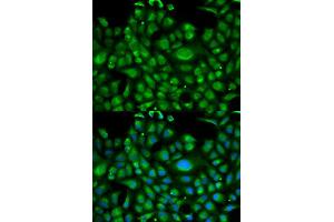 Immunofluorescence analysis of U2OS cell using HSPA1L antibody. (HSPA1L antibody  (AA 342-641))
