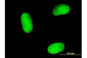 Immunofluorescence of purified MaxPab antibody to MAGEB1 on Hs 181. (MAGEB1 antibody  (AA 1-347))