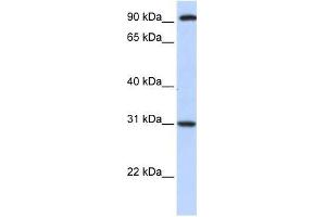 ANKRA2 antibody used at 0. (ANKRA2 antibody  (C-Term))