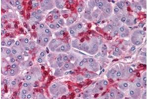 Human Pancreas: Formalin-Fixed, Paraffin-Embedded (FFPE) (HOXB7 antibody  (AA 55-121))