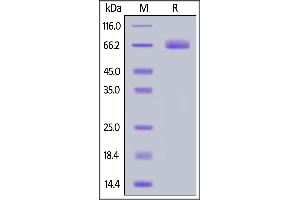 SDS-PAGE (SDS) image for CD276 (CD276) (AA 29-465) (Active) protein (His tag) (ABIN6938824)