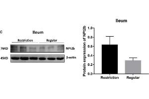 Effects of dietary non-phytate phosphorus levels (restriction, 0. (SLC34A2 antibody  (AA 234-362))