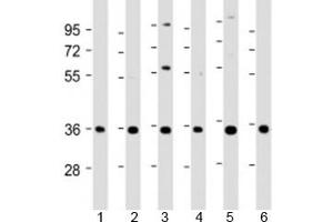 Western blot testing of human 1) A431, 2) HeLa, 3) HepG2, 4) Jurkat, 5) U-2OS and 6) SH-SY5Y cell lysate with NT5C3 antibody at 1:2000. (NT5C3 antibody  (AA 282-313))