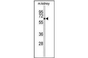 Western blot analysis of CYP27B1 Antibody (C-term)  in mouse kidney tissue lysates (35ug/lane). (CYP27B1 antibody  (C-Term))