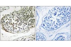 Immunohistochemistry analysis of paraffin-embedded human testis tissue, using UBQLN3 Antibody. (Ubiquilin 3 antibody  (AA 271-320))