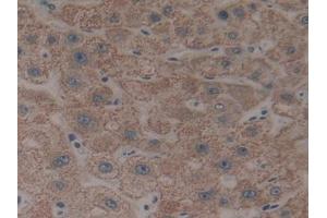 DAB staining on IHC-P; Samples: Human Liver Tissue (CYP26B1 antibody  (AA 1-512))