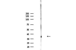 anti-Histo-blood group A transferase (ABO) (N-Term) antibody