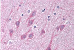 Human Brain, Cortex (formalin-fixed, paraffin-embedded) stained with TICAM1 antibody ABIN213993 at 5 ug/ml followed by biotinylated goat anti-rabbit IgG secondary antibody ABIN481713, alkaline phosphatase-streptavidin and chromogen. (TICAM1 antibody  (C-Term))