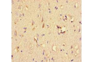Immunohistochemistry of paraffin-embedded human brain tissue using ABIN7169664 at dilution of 1:100 (STAT1 antibody  (AA 63-196))