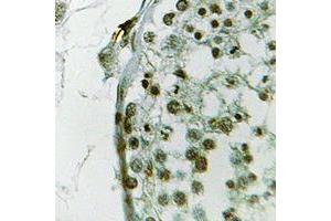 Immunohistochemical analysis of Ubiquilin 3 staining in human testis formalin fixed paraffin embedded tissue section. (Ubiquilin 3 antibody  (Center))