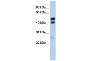 Lipase antibody (Gastric) used at 1 ug/ml to detect target protein. (Lipase (N-Term) antibody)